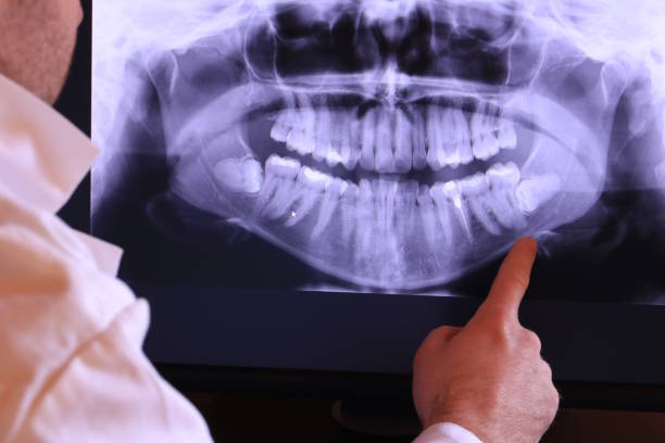 Best Emergency Tooth Extraction in Volcano Golf Course, HI